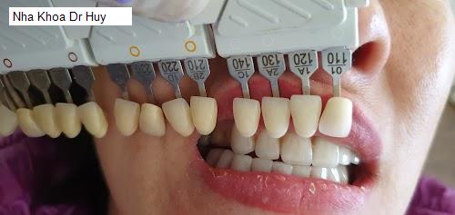 Hình ảnh Nha Khoa Dr Huy