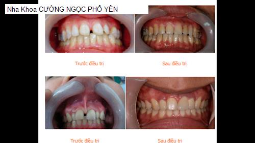 Hình ảnh Nha Khoa CƯỜNG NGỌC PHỔ YÊN